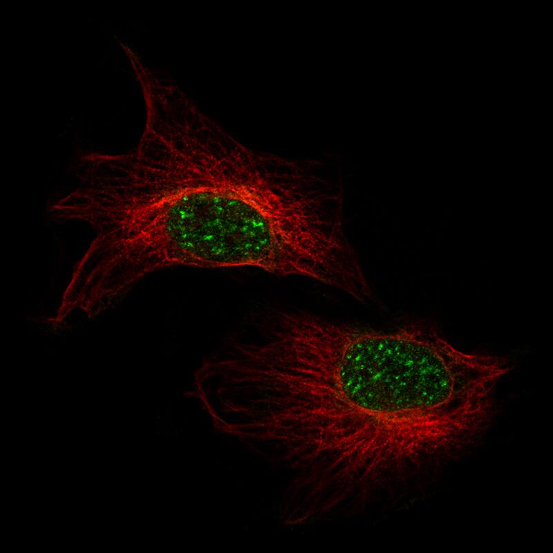 Immunocytochemistry/ Immunofluorescence AlphaB Crystallin/CRYAB Antibody (CL10758) - BSA Free