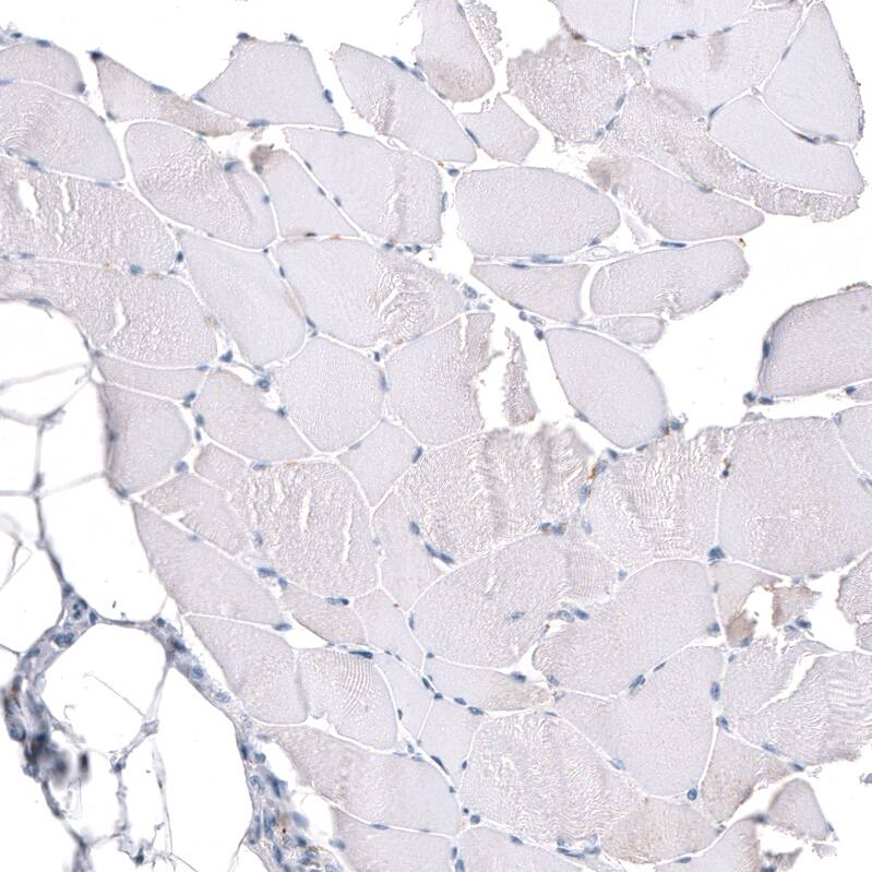 Staining of human skeletal muscle shows no positivity in myocytes as expected.