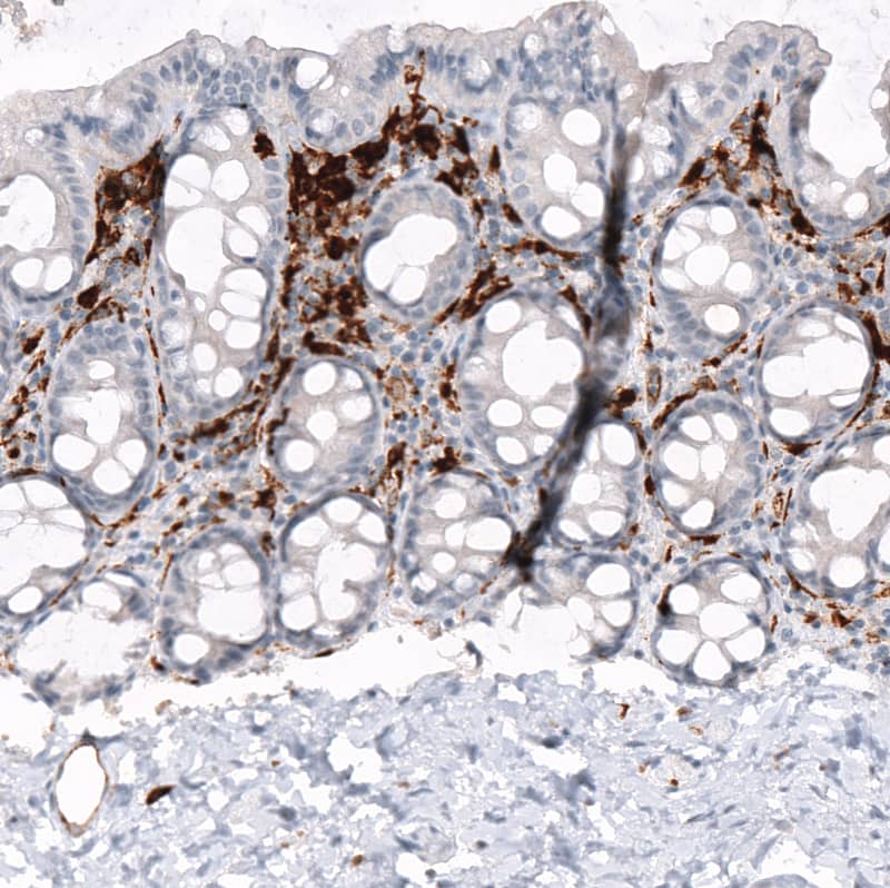 Staining of human rectum shows strong cytoplasmic positivity in lymphoid cells.