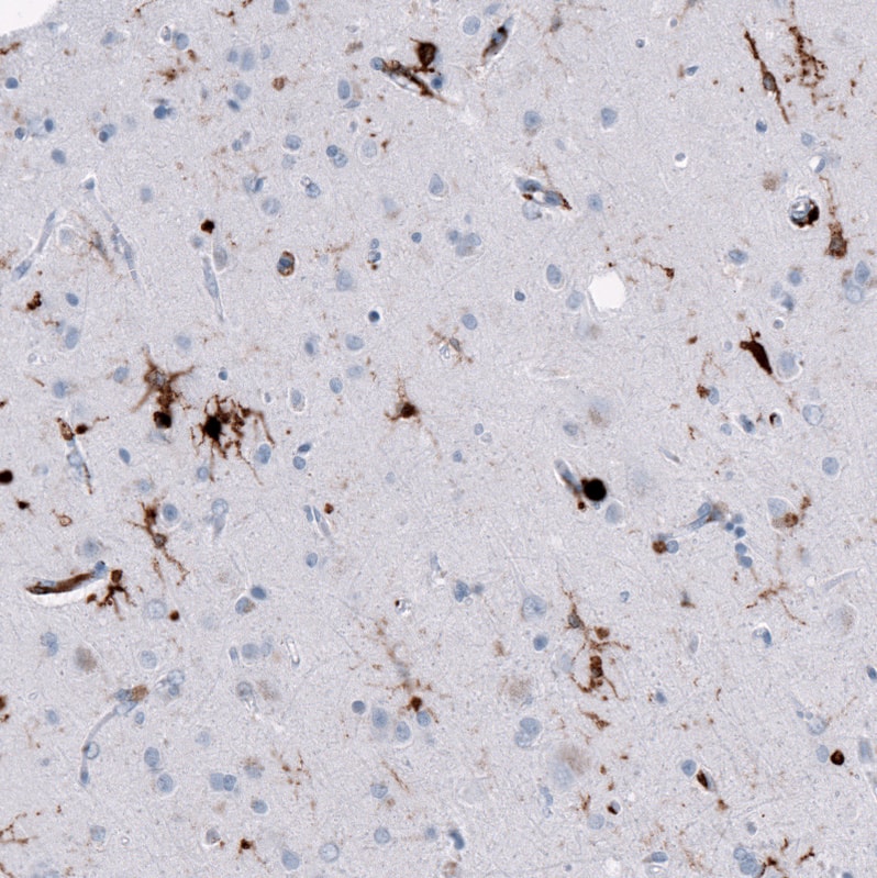 Staining of human cerebral cortex (Alzheimer disease) shows moderate to strong cytoplasmic positivity in microglia.