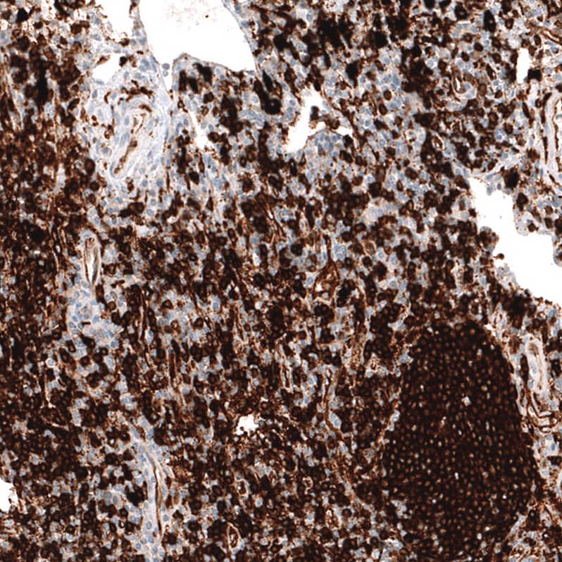 Staining of human lymph node shows strong membranous positivity in germinal center cells.