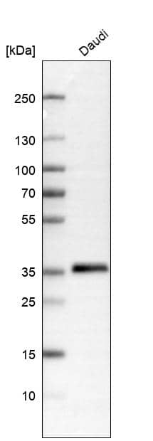 Analysis in human cell line Daudi.