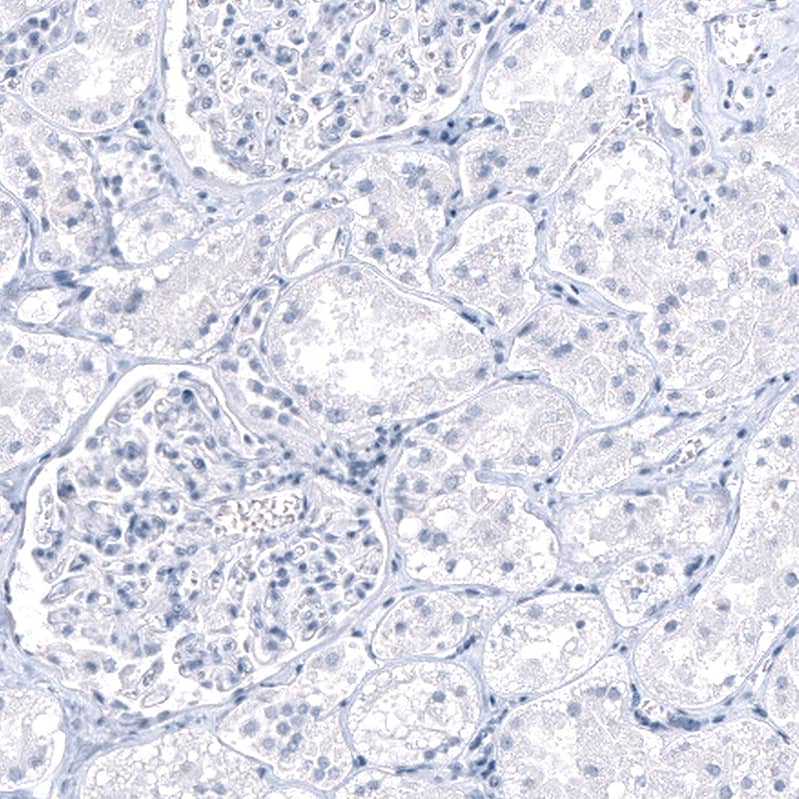 <b>Orthogonal Strategies Validation. </b>Staining of human Kidney shows no positivity in cells in seminiferous ducts as expected.