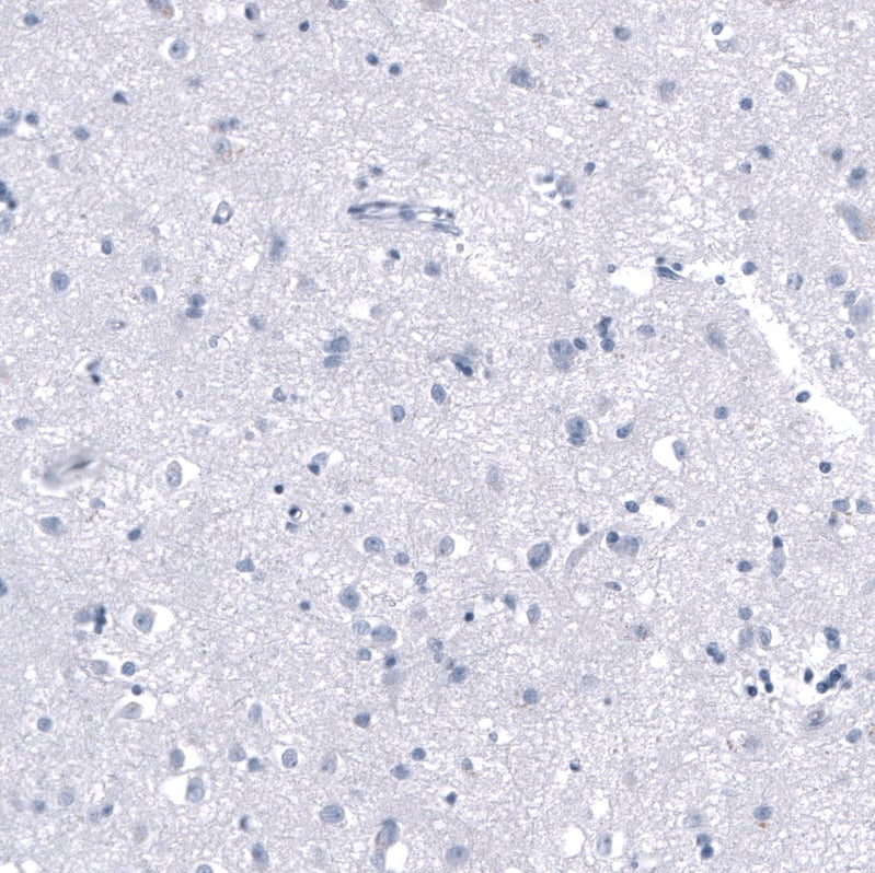 Staining of human Cerebral cortex shows very weak cytoplasmic positivity in neuronal cells.