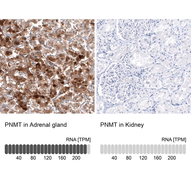 Analysis in human adrenal gland and kidney tissues using NBP3-21193 antibody. Corresponding PNMT RNA-seq data are presented for the same tissues.