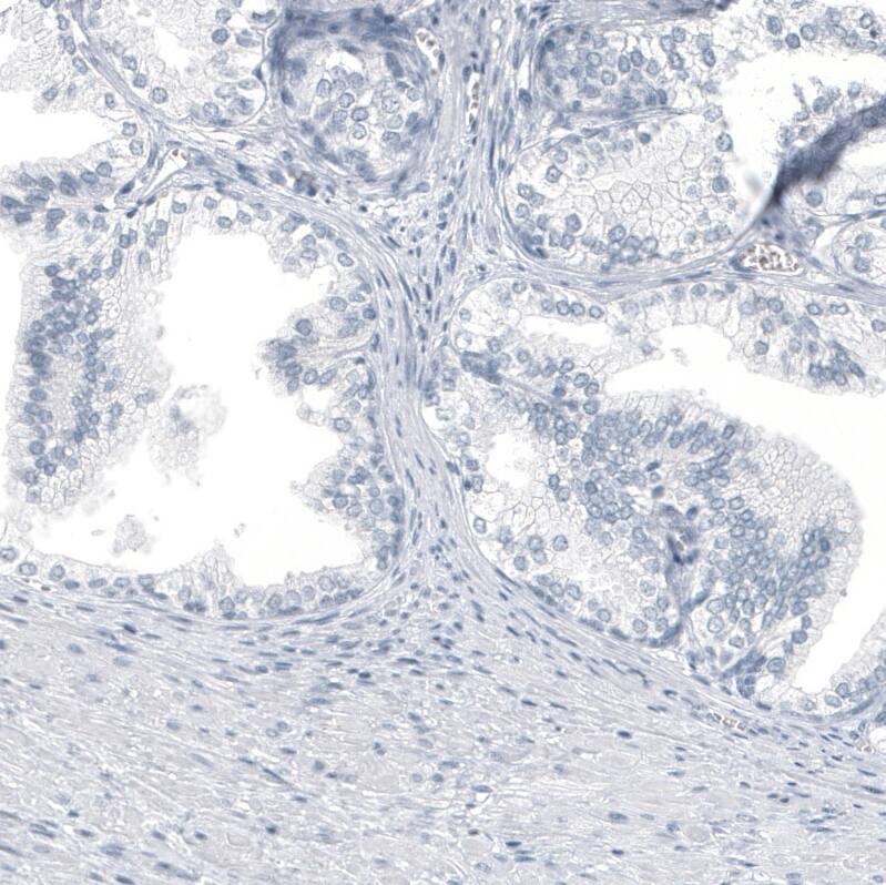 Staining of human prostate shows no positivity in glandular cells as expected.