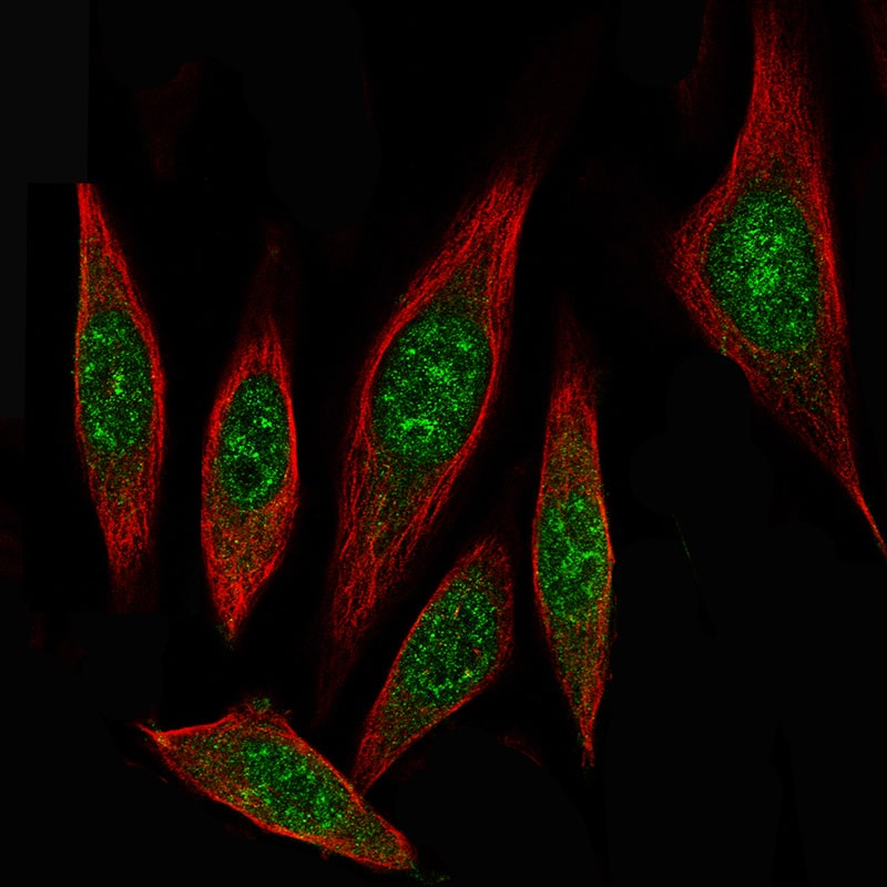 Staining of PC-3 cells, showing specific staining in nucleoplasm in green. Microtubule probe is visualized in red.
