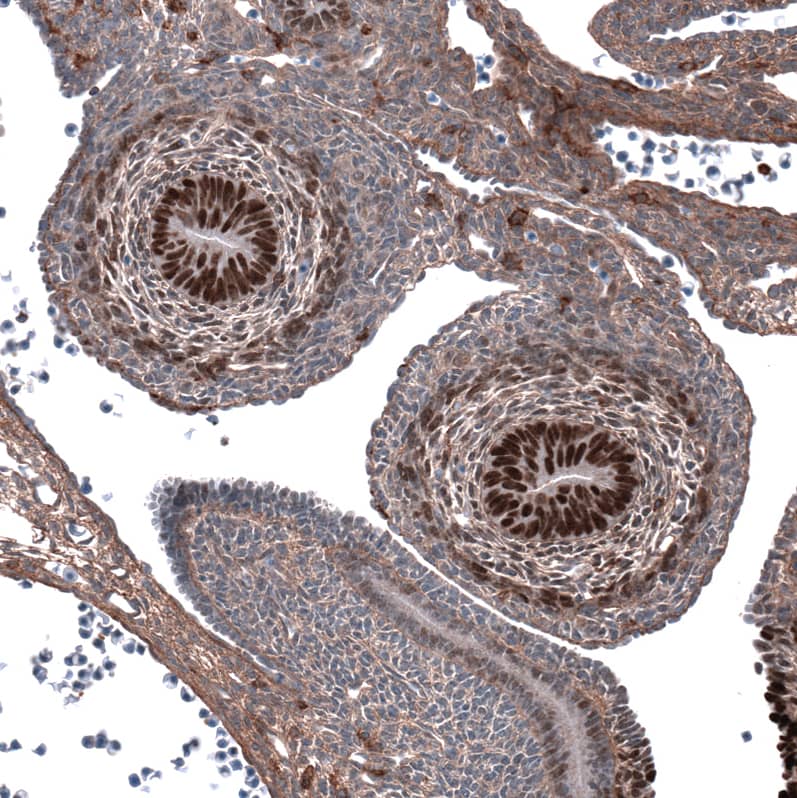 Staining of mouse embryo E11 shows strong nuclear positivity in cells in developing testis.