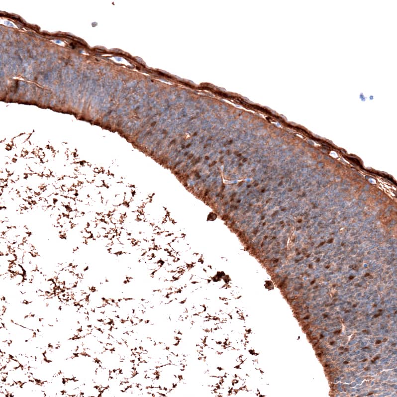 Staining of mouse embryo E11 shows moderate to strong nuclear positivity in cells in developing hindbrain.