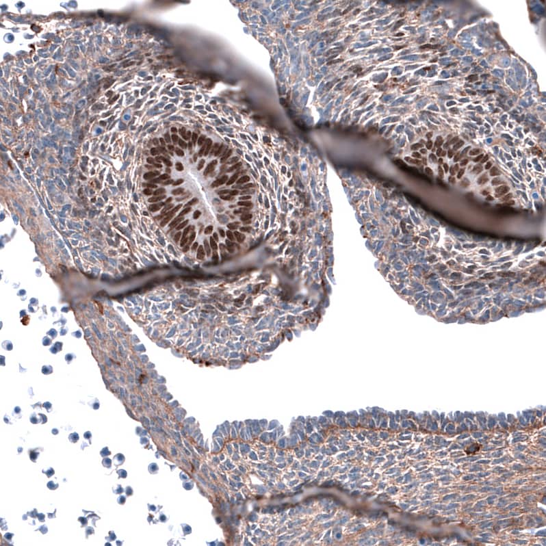 Staining of mouse embryo E11 shows strong nuclear positivity in cells in developing testis.