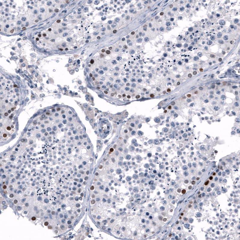 Staining of human testis shows moderate to strong nuclear positivity in a subset of cells in seminiferous ducts.