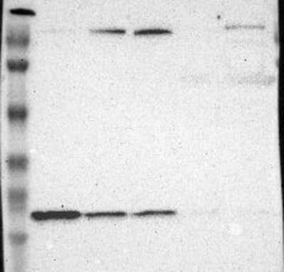 Lane 1: Marker [kDa] 219, 112, 85, 49, 32, 25, 17.5 | Lane 2: RT4 | Lane 3: U-251 MG | Lane 4: A-431 | Lane 5: Liver | Lane 6: Tonsil