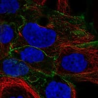 Staining of human cell line EFO-21 shows localization to plasma membrane & cell junctions.