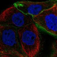 Staining of human cell line EFO-21 shows localization to plasma membrane & cell junctions.