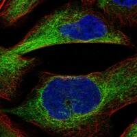 Staining of human cell line RH-30 shows localization to cytosol & intermediate filaments.