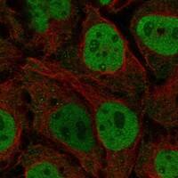 Staining of human cell line CACO-2 shows localization to nucleoplasm & nucleoli fibrillar center.