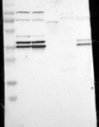 Lane 1: Marker [kDa] 230, 130, 95, 72, 56, 36, 28, 17, 11 | Lane 2: RT4 | Lane 3: U-251 MG | Lane 4: Human Plasma | Lane 5: Liver | Lane 6: Tonsil