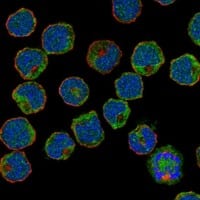 Staining of human cell line HEL shows localization to cytosol.
