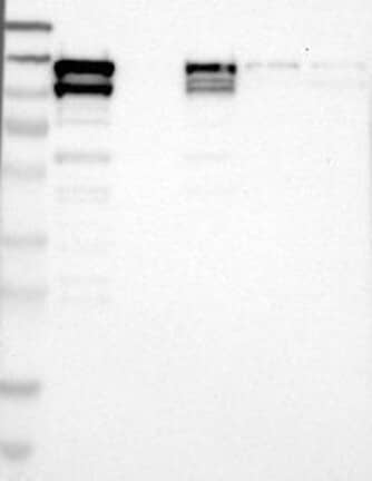 Lane 1: Marker [kDa] 230, 130, 95, 72, 56, 36, 28, 17, 11 | Lane 2: RT4 | Lane 3: Human Plasma | Lane 4: U-251 MG | Lane 5: Liver | Lane 6: Tonsil