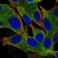 Staining of human cell line SH-SY5Y shows localization to cytosol.
