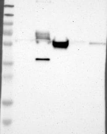 Lane 1: Marker [kDa] 230, 130, 95, 72, 56, 36, 28, 17, 11 | Lane 2: RT4 | Lane 3: U-251 MG | Lane 4: Human Plasma | Lane 5: Liver | Lane 6: Tonsil