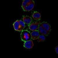 Staining of human cell line HDLM-2 shows localization to plasma membrane.