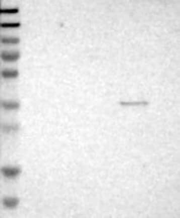 Lane 1: Marker [kDa] 230, 130, 95, 72, 56, 36, 28, 17, 11 | Lane 2: RT4 | Lane 3: U-251 MG | Lane 4: Human Plasma | Lane 5: Liver | Lane 6: Tonsil