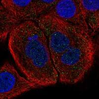 Staining of human cell line HaCaT shows localization to vesicles.