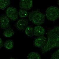 Staining of human cell line HEL shows localization to nucleoplasm & nuclear bodies.