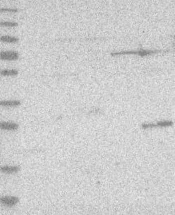 Lane 1: Marker [kDa] 230, 130, 95, 72, 56, 36, 28, 17, 11 | Lane 2: RT4 | Lane 3: U-251 MG | Lane 4: Human Plasma | Lane 5: Liver | Lane 6: Tonsil