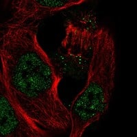Staining of human cell line EFO-21 shows localization to nucleoplasm & vesicles.