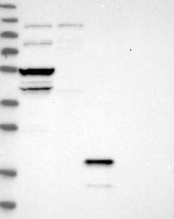 Lane 1: Marker [kDa] 230, 130, 95, 72, 56, 36, 28, 17, 11 | Lane 2: RT4 | Lane 3: U-251 MG | Lane 4: Human Plasma | Lane 5: Liver | Lane 6: Tonsil