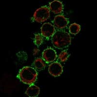 Staining of human cell line HDLM-2 shows localization to plasma membrane & centriolar satellites.
