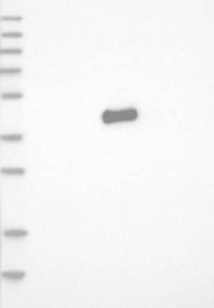 Lane 1: Marker [kDa] 230, 130, 95, 72, 56, 36, 28, 17, 11 | Lane 2: RT4 | Lane 3: U-251 MG | Lane 4: Human Plasma | Lane 5: Liver | Lane 6: Tonsil