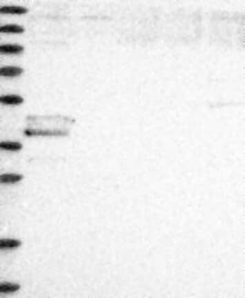 Lane 1: Marker [kDa] 230, 130, 95, 72, 56, 36, 28, 17, 11 | Lane 2: RT4 | Lane 3: U-251 MG | Lane 4: Human Plasma | Lane 5: Liver | Lane 6: Tonsil