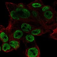 Staining of human cell line Hep G2 shows localization to nucleoplasm.