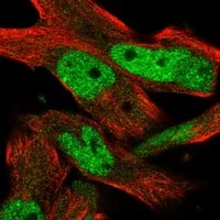 Staining of human cell line RH-30 shows localization to nucleoplasm.