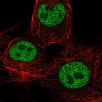 Staining of human cell line SuSa shows localization to nucleoplasm.