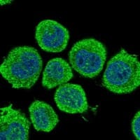 Staining of human cell line HEL shows localization to plasma membrane & cytosol.