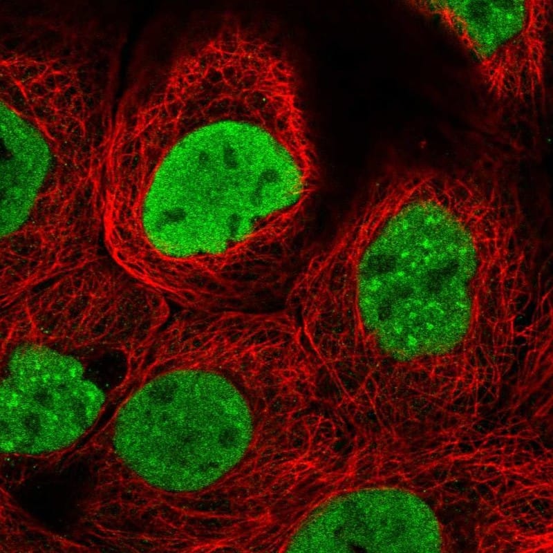 Staining of human cell line A-431 shows localization to nucleoplasm & nuclear speckles.