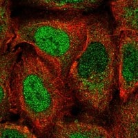 Staining of human cell line U-2 OS shows localization to nucleoplasm & cytosol.