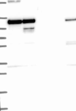 Lane 1: Marker [kDa] 250, 130, 95, 72, 55, 36, 28, 17, 10 | Lane 2: RT4 | Lane 3: U-251 MG | Lane 4: Human Plasma | Lane 5: Liver | Lane 6: Tonsil