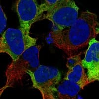 Staining of human cell line AF22 shows localization to nucleoli & cytosol.