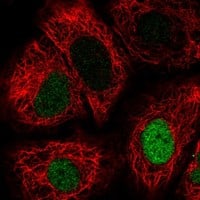 Staining of human cell line A549 shows localization to nucleoplasm.