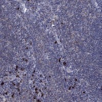 Staining of human tonsil shows strong cytoplasmic positivity in non-germinal center cells.