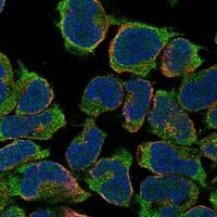 Staining of human cell line JURKAT shows localization to plasma membrane.