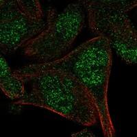 Staining of human cell line RH-30 shows localization to nucleoplasm.