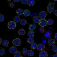 Staining of human cell line REH shows localization to plasma membrane.