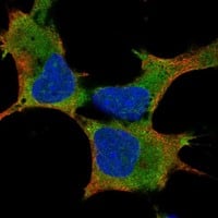 Staining of human cell line AF22 shows localization to nucleoli & cytosol.