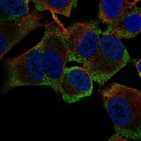 Staining of human cell line SH-SY5Y shows localization to cytosol.